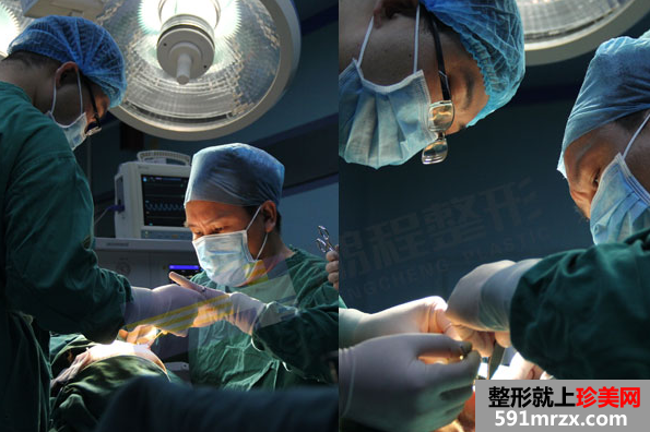 深圳鹏程整形医院拉皮鼻修复真实案例对比图