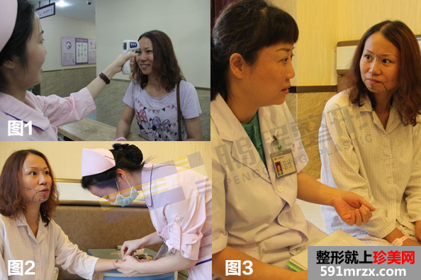深圳鹏程整形医院拉皮鼻修复真实案例对比图