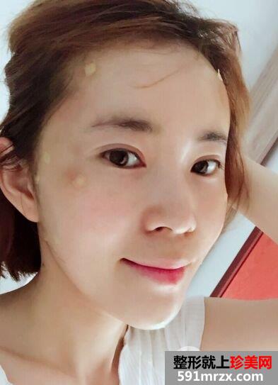 +֬ȫ沿ʵǰƬ