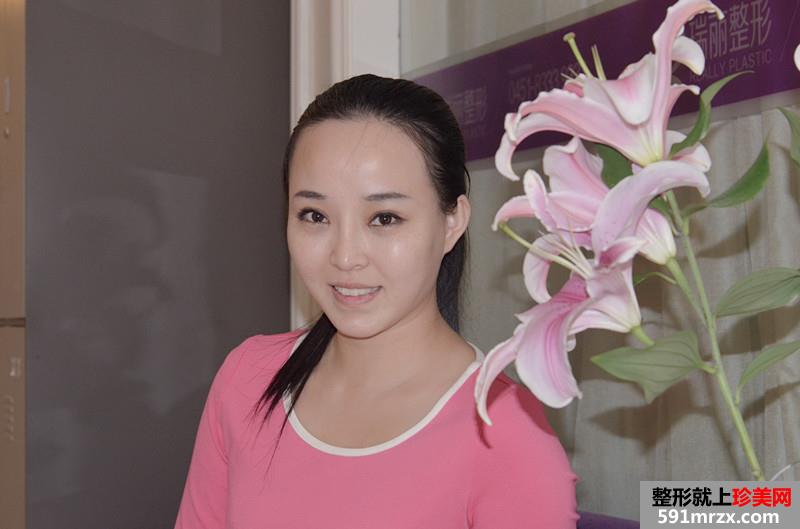 3度仿生美鼻+彩光祛雀斑+多维立体丰下颏前后对比效果图片