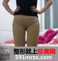 臀部吸脂术 超级无敌变身美少女 臀部吸脂术 超级无敌变身美少女