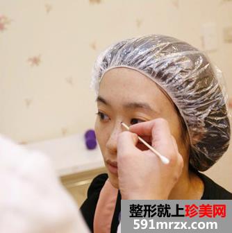 真实,案例,注射,乔雅登,玻尿酸,隆鼻,前后,对比图