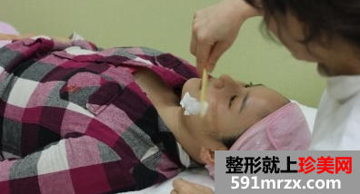 棱角下巴矫正术+硅胶隆鼻整形前后效果对比图和恢复过程