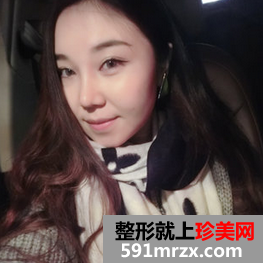 面部吸脂减肥 朋友不再叫我胖子脸