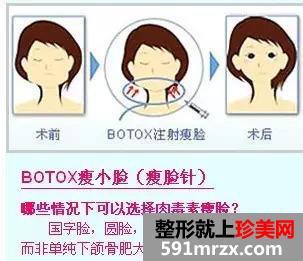 ,,,ҽԺ,botox,