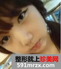 颧骨整形日记 变美需要勇气!
