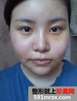 图片4.png