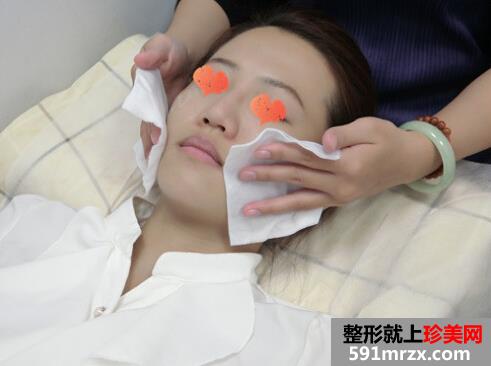 打玻尿酸后 苹果肌饱满鼻子也变翘了!