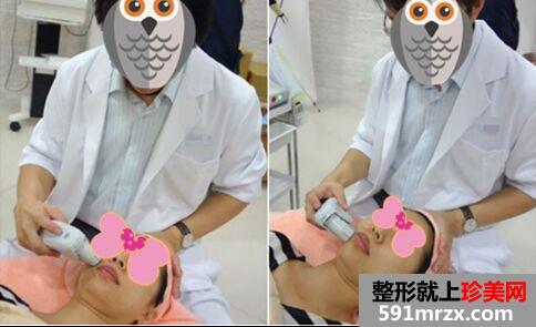 大龄宝妈做完音波拉皮变身美少女~