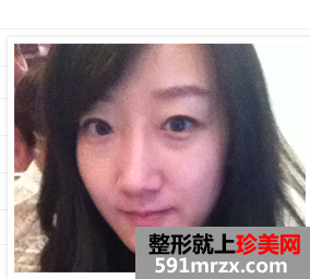 北京,明会红,国际,医疗,美容,机构,隆鼻,去眼袋,从平凡到惊艳