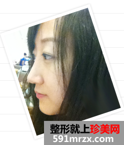 北京,明会红,国际,医疗,美容,机构,隆鼻,去眼袋,从平凡到惊艳