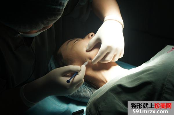 打瘦脸针,溶脂,去眼袋,手术,过程,前后,对比图,真实,案例