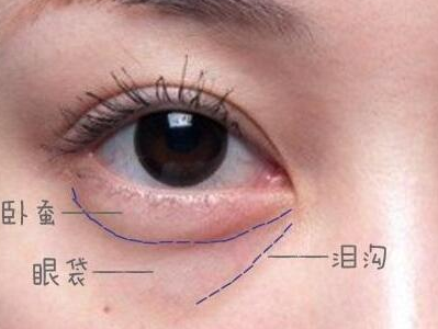 bybiotic去眼袋怎么样