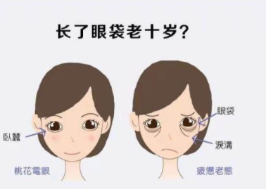 经常熬夜眼袋很大怎么办