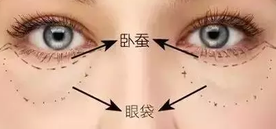 超声波祛眼袋多少费用