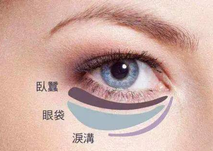 广州做去眼袋手术多少钱