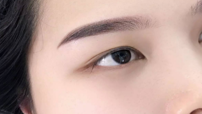 怎么快速有效消除眼袋