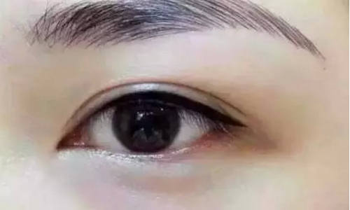 眼袋切除的治疗费用