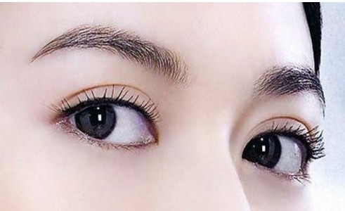 做眼袋需要注意什么