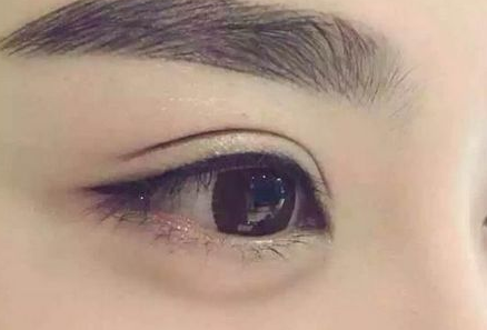 开眼角手术冰敷多久