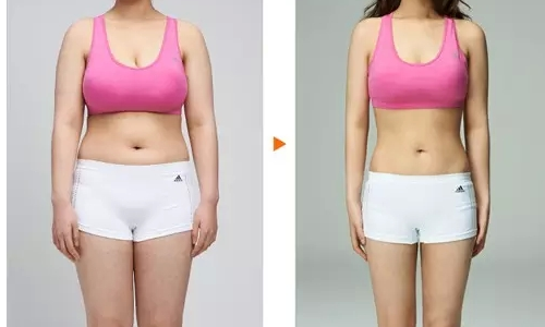 巨乳缩小术有效果吗