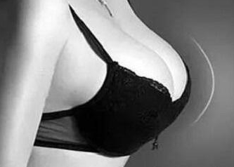 副乳切除效果如何