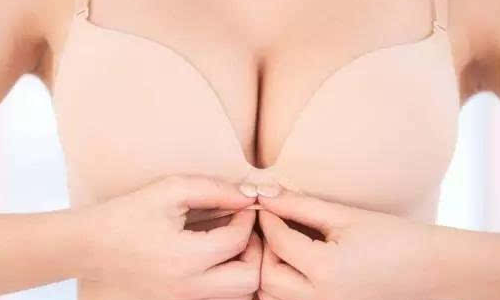 切除副乳效果真实吗