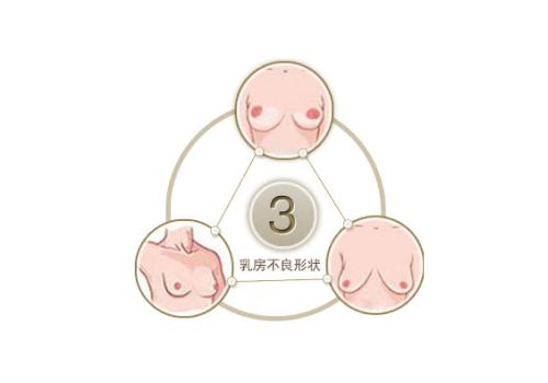 假体隆胸手术的危害