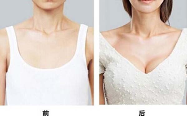 隆胸术后的不良反应