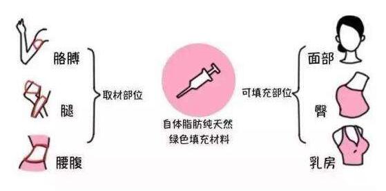 脂肪移植手术风险