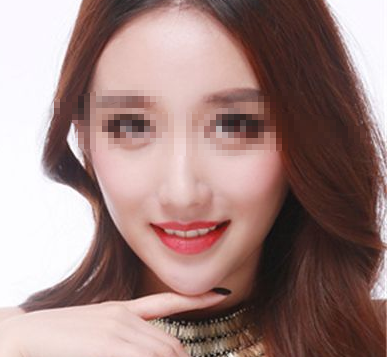 脂肪填充并不是永久