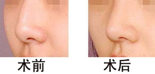 շǵ4Ʒʽ