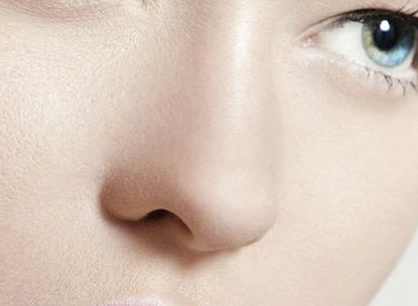 鼻头大该怎么办