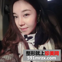 面部吸脂减肥 朋友不再叫我胖子脸