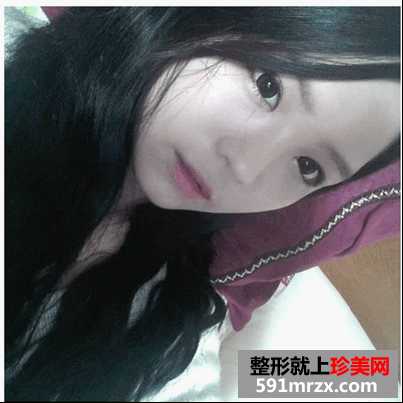 开眼角前后对比图