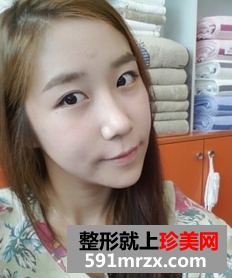3D回转颧骨术+下颌角磨骨整形前后效果对比图和恢复过程