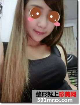 玻尿酸垫鼻子+下巴让我长相更精致了
