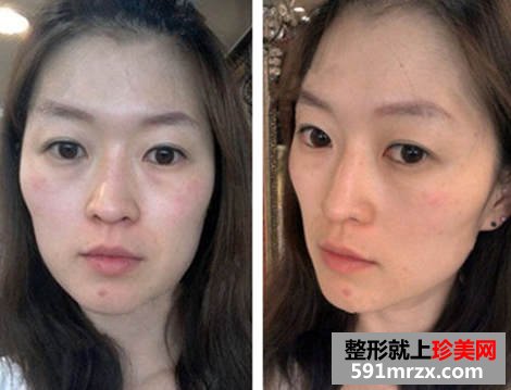 女网友面部太瘦显老