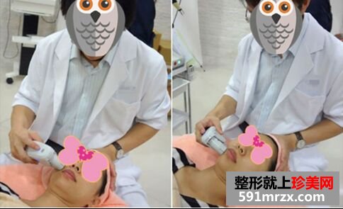 大龄宝妈做完音波拉皮变身美少女~