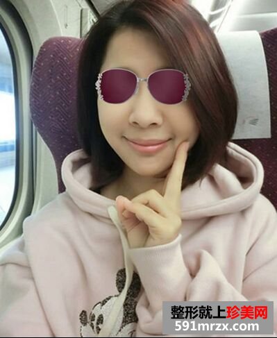 大龄宝妈做完音波拉皮变身美少女~