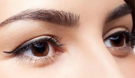 全切双眼皮恢复期需要注意哪些