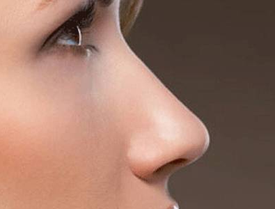 缩鼻翼手术有什么危害吗