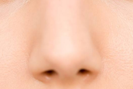 鼻翼缩小的原理是什么