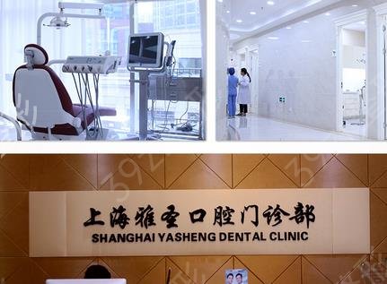 上海全口假牙哪个医院好
