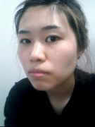 北京割双眼皮+硅胶隆鼻+面部轮廓整形前后对比